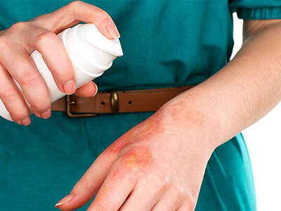 Засоби при травмах і опіках